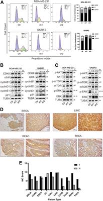 Integrative analysis of the role of BOLA2B in human pan-cancer